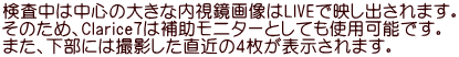 検査中は中心の大きな内視鏡画像はLIVEで映し出されます。 そのため、Clarice7は補助モニターとしても使用可能です。 また、下部には撮影した直近の4枚が表示されます。